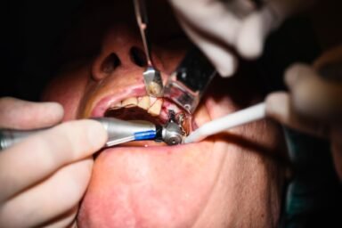 https://veeh.sterling-academy.com/wp-content/uploads/2025/06/dental-surgery-e1750320096993.jpg